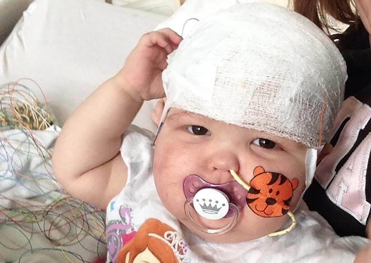 A baby girl with a bandage on her head; family